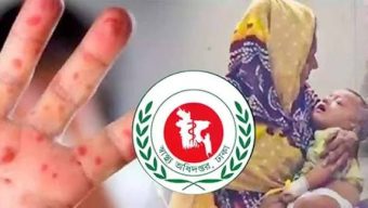 Three more deaths linked to measles symptoms